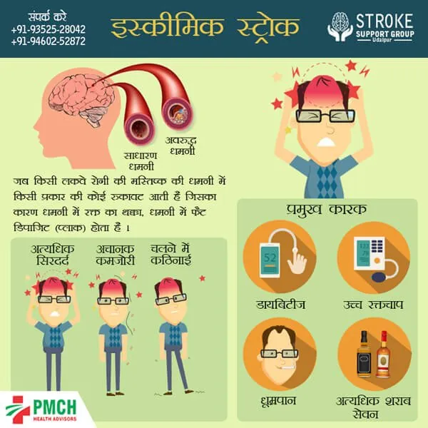 Ischemic stroke explainer — social & posters by Udaipur Graphic Designer